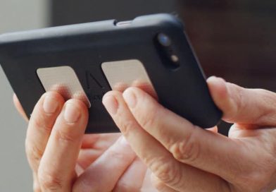 Alivecor’s answer to the Apple Watch ECG is a more accurate 6-lead smartphone ECG