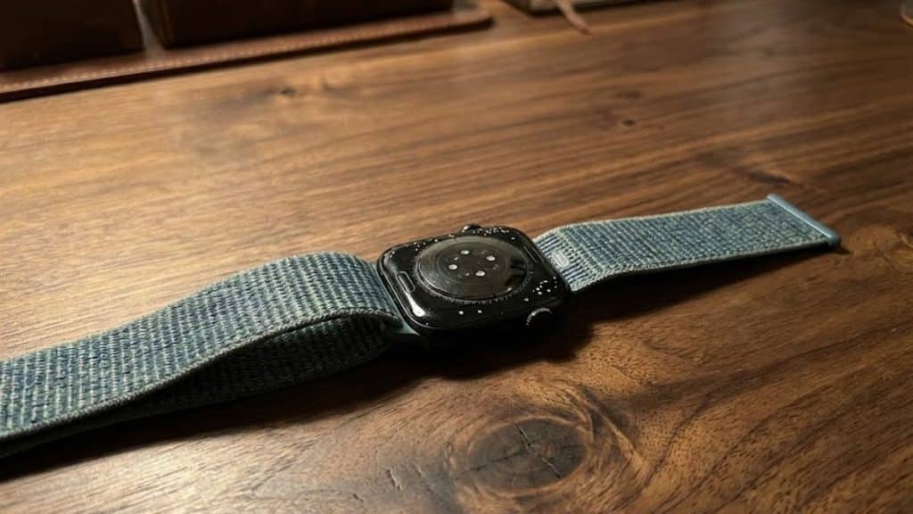 Apple Watch Corrosion