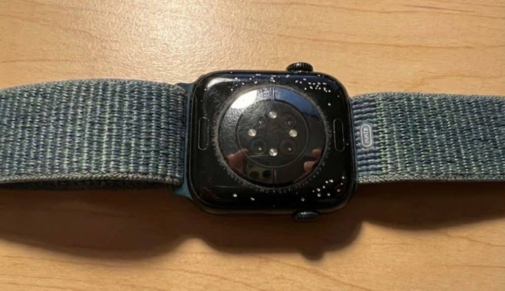 Apple Watch Corrosion