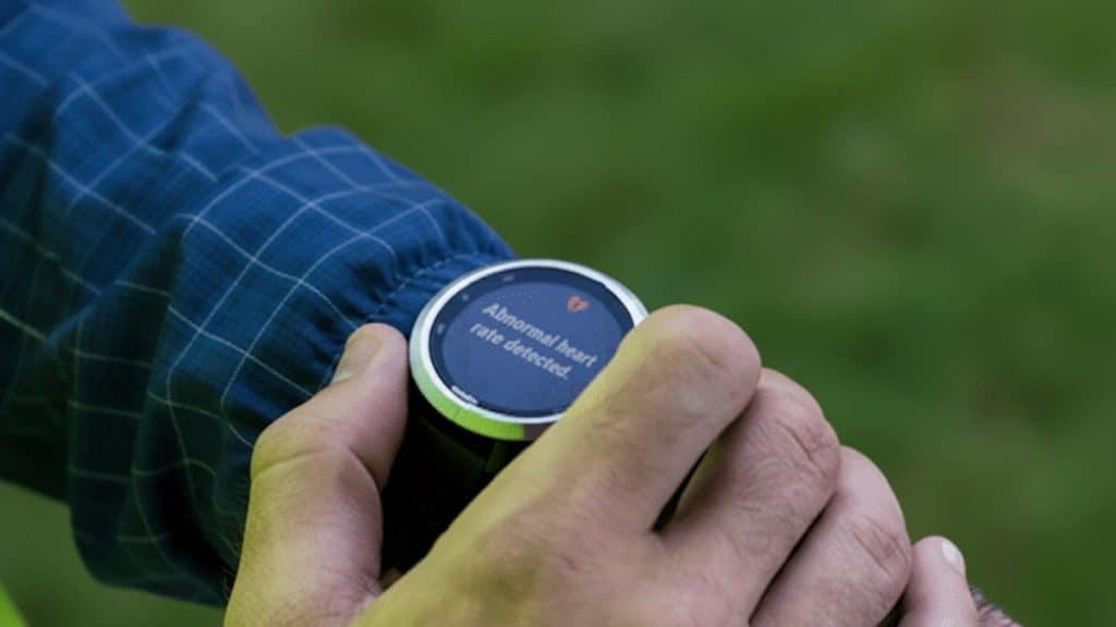 Garmin abnormal heart rate