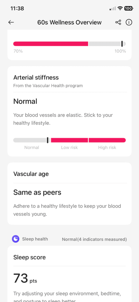 OnePlus Watch Lite app