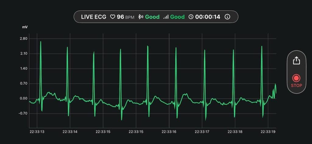 ECG live streaming