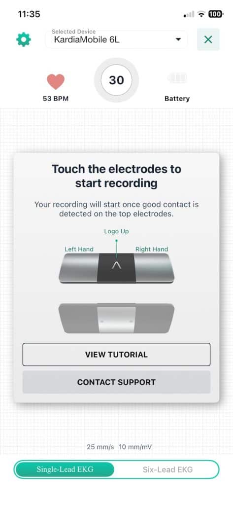 KardiaMobile 6L single lead reading
