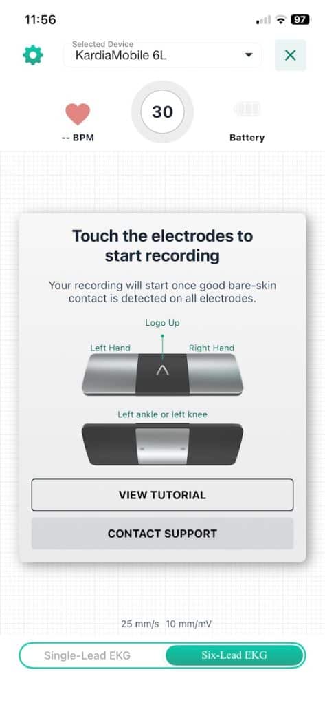 KardiaMobile 6L six lead reading