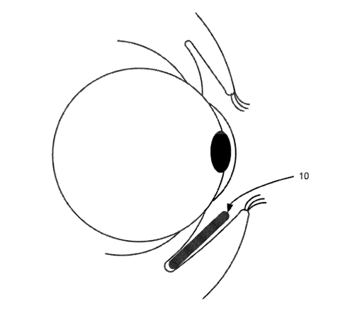 Verily glucose patent